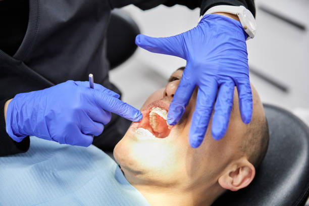 Best Emergency Dentist for Lost Fillings or Crowns in Benjamin, UT